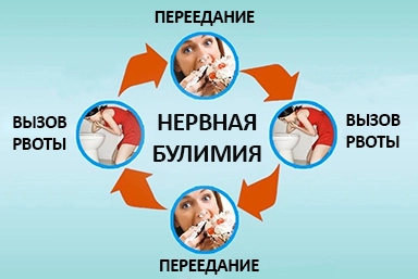Лечение булимии в Антраците